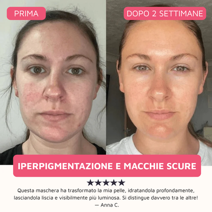 Maschera al Bio-Collagene Gentili™